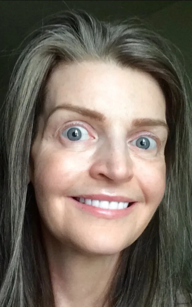 Beth — day 180
