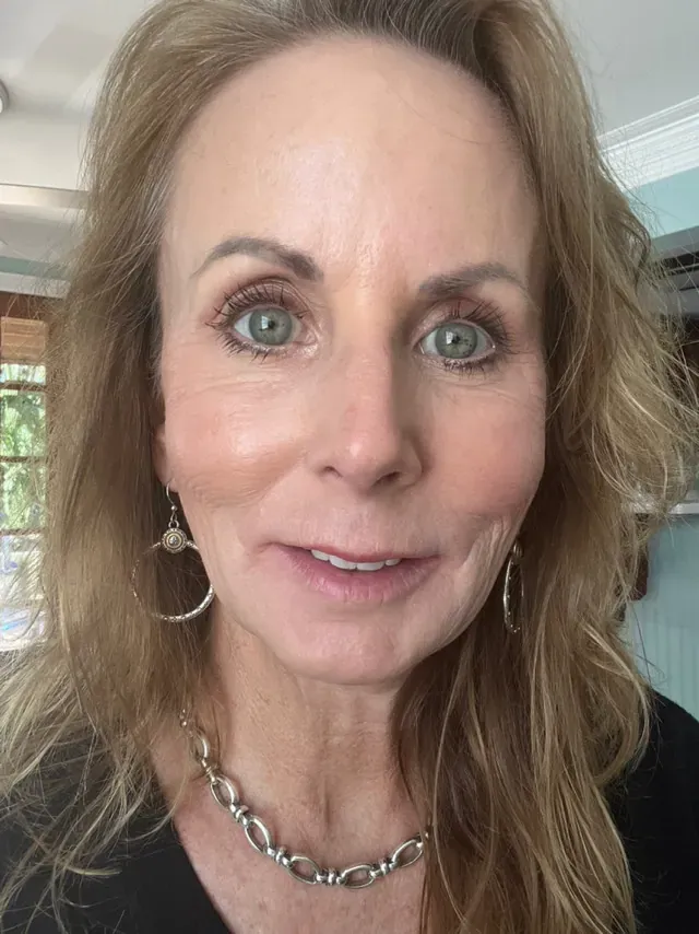 Denise R. after