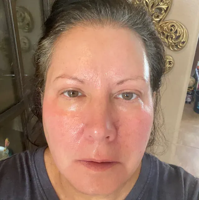 Donna P. after