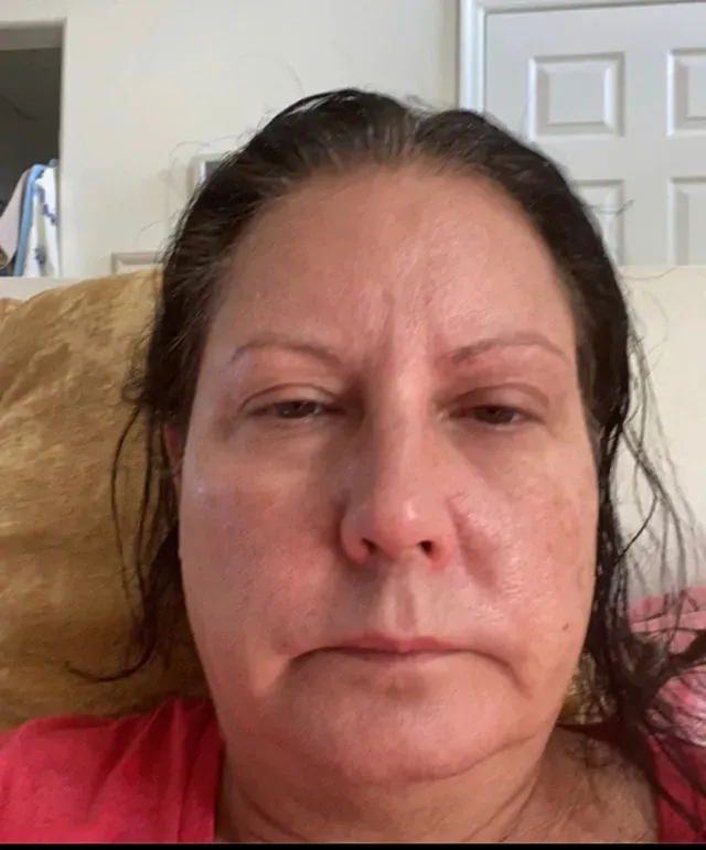 Donna P. before