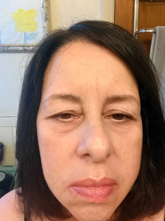 Karen H. after