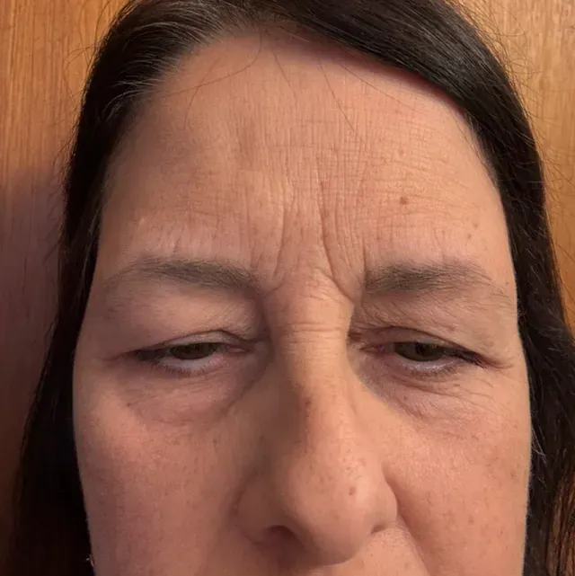 Karen H. before