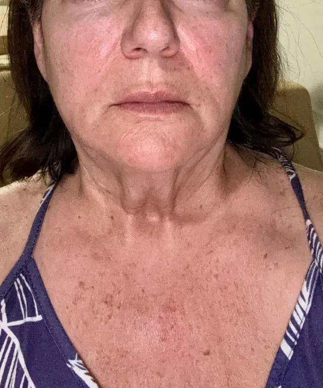 Michelle A. before