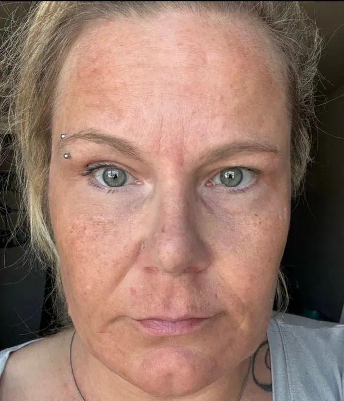 Monica C. before