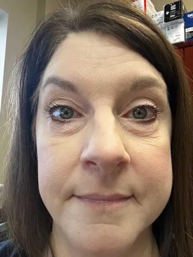 Sandra K. before